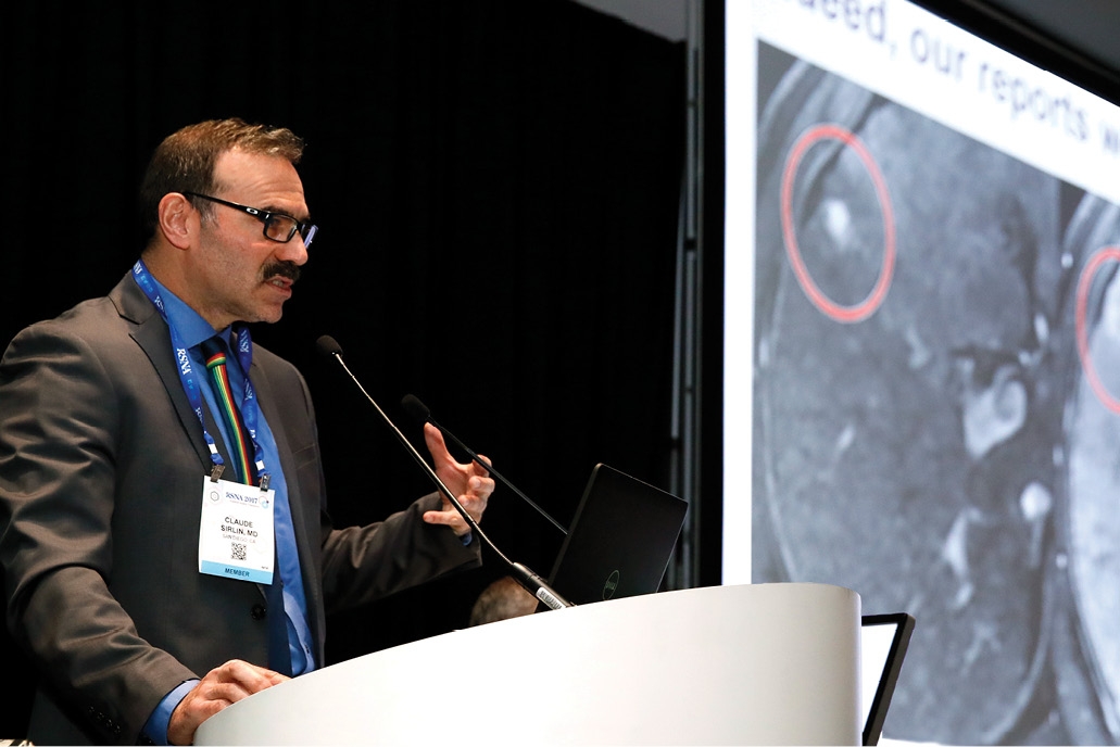 LI-RADS Promotes Improved Liver Imaging Techniques, Reportin | RSNA 2017